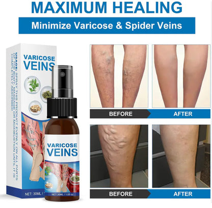 VARICOSE VEINS - Spray Anti Varices 100% Natural